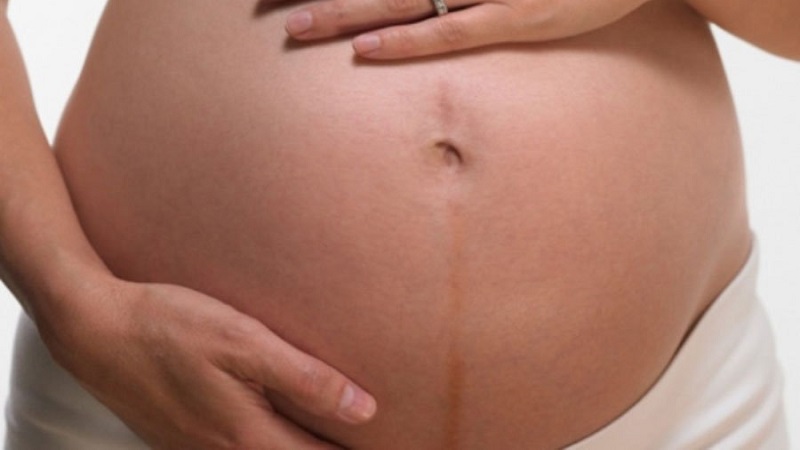 خط سیاه روی شکم در بارداری | متخصص زنان اصفهان