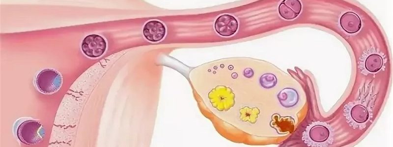 روش های تشخیص و درمان عدم تخمک گذاری