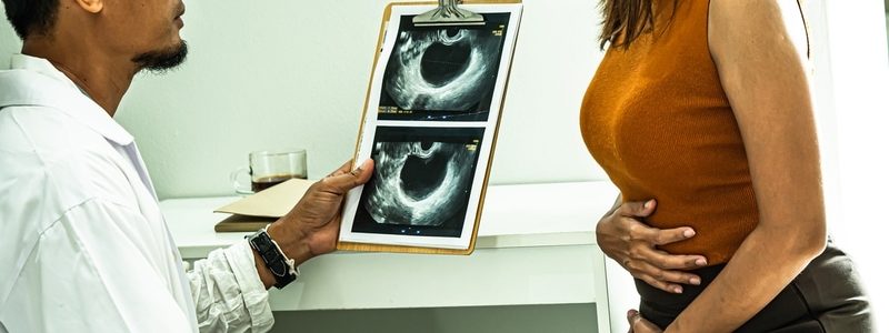 سرطان و احتمال پارگی کیست تخمدان